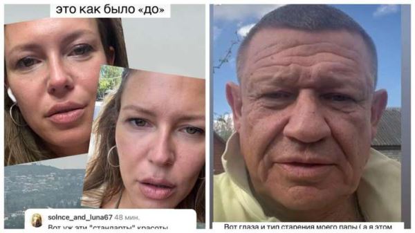 Не хотела «лисьи глазки»: Рита Дакота объяснила, что толкнуло ее на пластику век