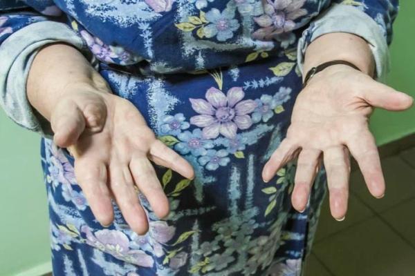 Эти продукты заставят ваши суставы работать как в молодости: включите их в рацион после 60 лет