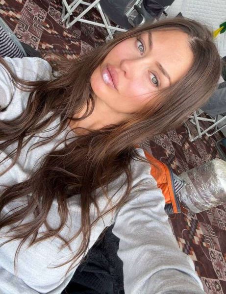 Показавшая болячку на лице Боня пожаловалась на здоровье