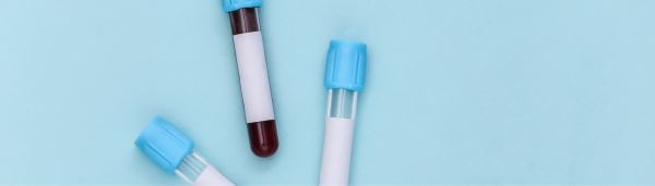 FDA одобрило тест‑систему для диагностики болезни Альцгеймера по анализу крови