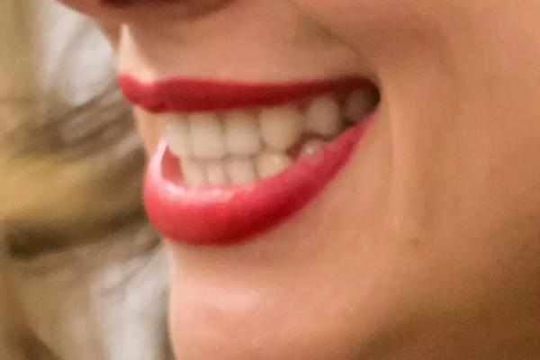 Что делать, если ночью разболелся зуб: все способы усмирить зубную боль 